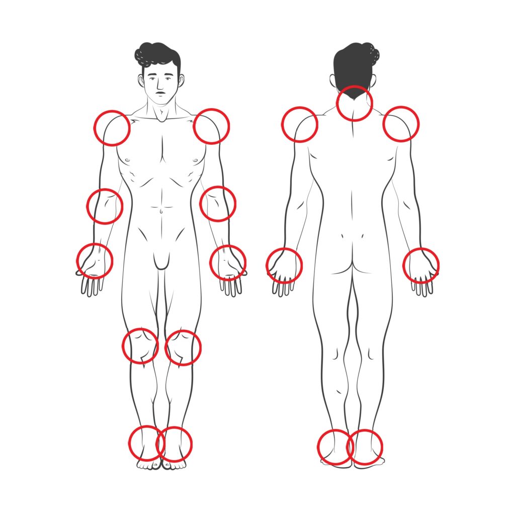 Obrazek przedstawia człowieka i punkty na nim w których najczęściej występuje RZS